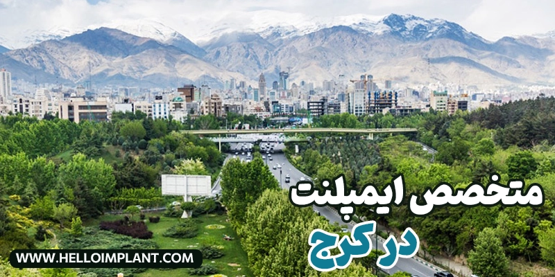 لیست بهترین متخصص ایمپلنت در کرج