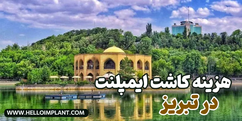 قیمت ایمپلنت فوری دندان در تبریز چقدر است؟