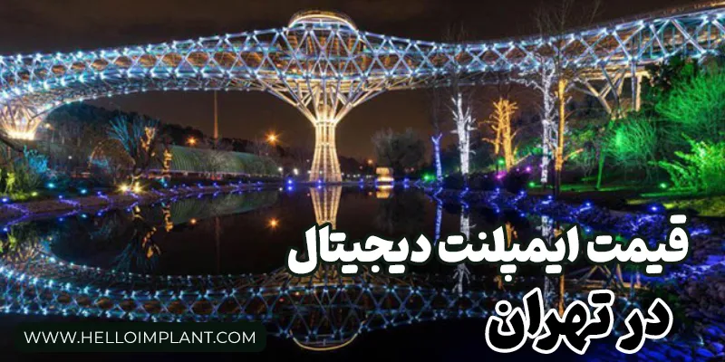 قیمت ایمپلنت دیجیتال دندان در تهران چقدر است؟