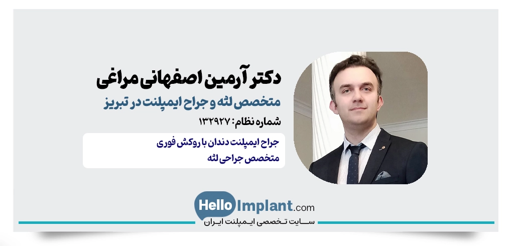 دکتر آرمین اصفهانی مراغی؛ از بهترین ایمپلنتولوژیست تبریز