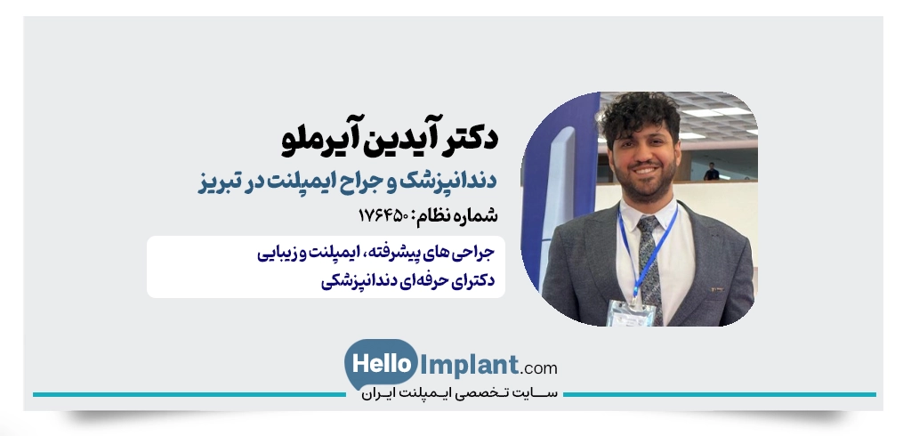 دکتر آیدین آیرملو؛ دندانپزشک خوب برای ایمپلنت در تبریز