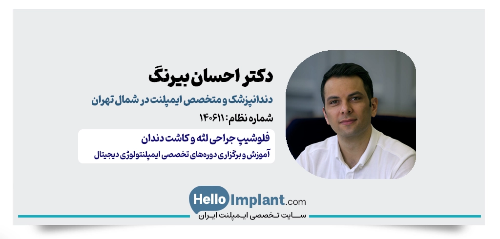دکتر احسان بیرنگ | متخصص ایمپلنت در شمال تهران