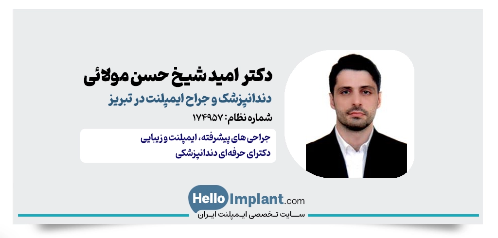 دکتر امید شیخ حسن مولائی؛ جراح ایمپلنت در تبریز