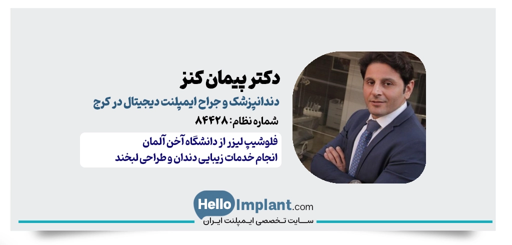 دکتر پیمان کنز | دندانپزشک و جراح ایمپلنت لیزری در کرج