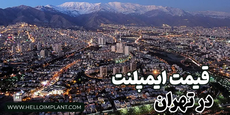 هزینه کاشت ایمپلنت در شمال تهران_ سال 1403
