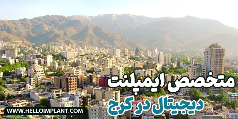 ایمپلنت دیجیتال در کرج؛ معرفی بهترین متخصصین و مراکز تخصصی
