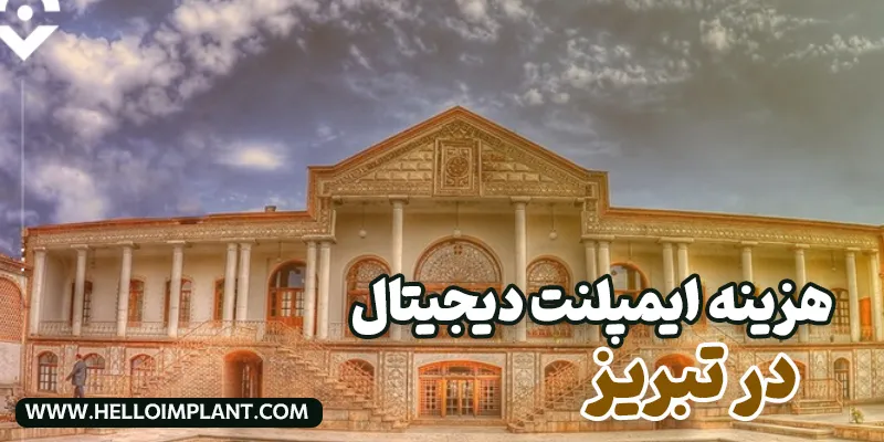 هزینه ایمپلنت دیجیتال در تبریز چقدر است؟