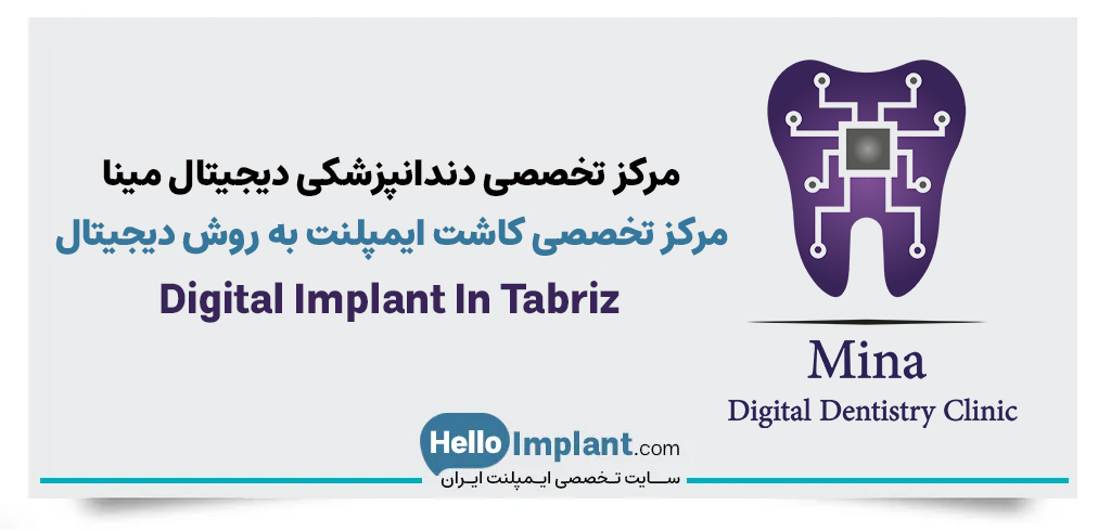 مرکز تخصصی دندانپزشکی دیجیتال مینا