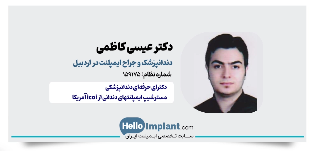 دکتر عیسی کاظمی؛ دندانپزشکی زیبایی در اردبیل بهترین جراح ایمپلنت اردبیل جراح ایمپلنت در اردبیل 