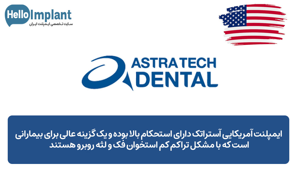 ایمپلنت آمریکایی Previously Astra