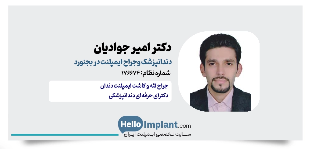 دکتر امیر جوادیان دندانپزشک ایمپلنت در بجنورد