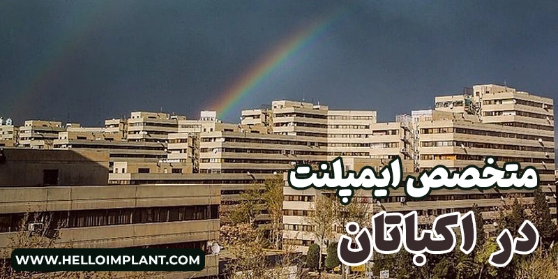 ایمپلنت در شهرک اکباتان | لیست دندانپزشکی در اکباتان