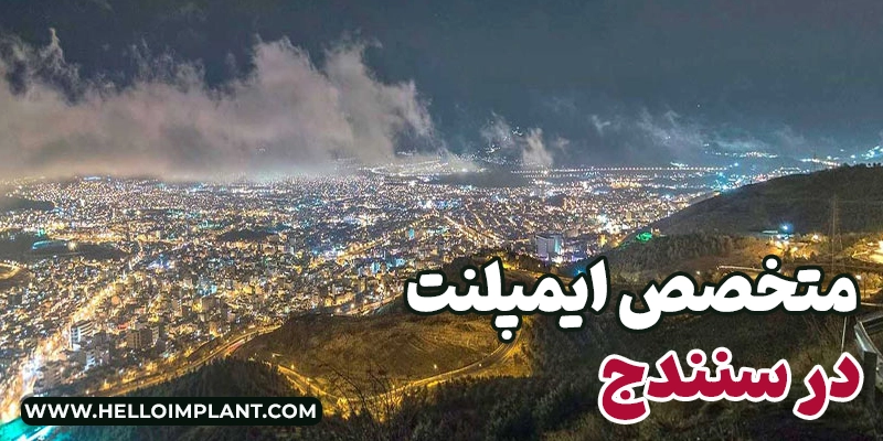 معرفی 14 تا از بهترین دکتر ایمپلنت سنندج