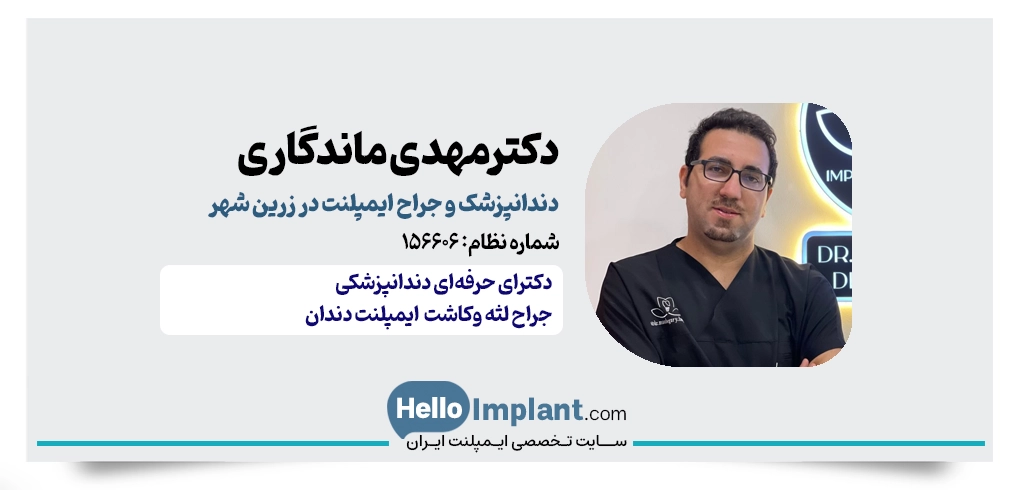 دکتر مهدی ماندگاری | جراح ایمپلنت در زرین‌ شهر