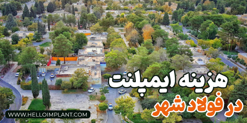 قیمت ایمپلنت در فولادشهر