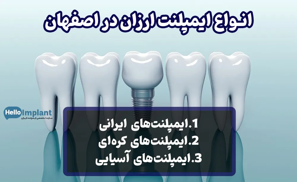 انواع ایمپلنت ارزان در اصفهان