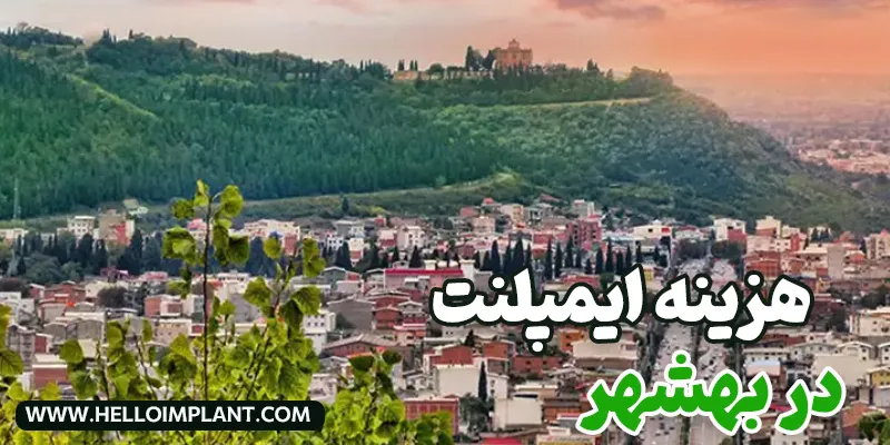 قیمت ایمپلنت دندان در بهشهر چقدر است؟