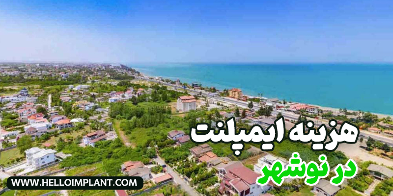 قیمت ایمپلنت دندان نوشهر چقدر است؟