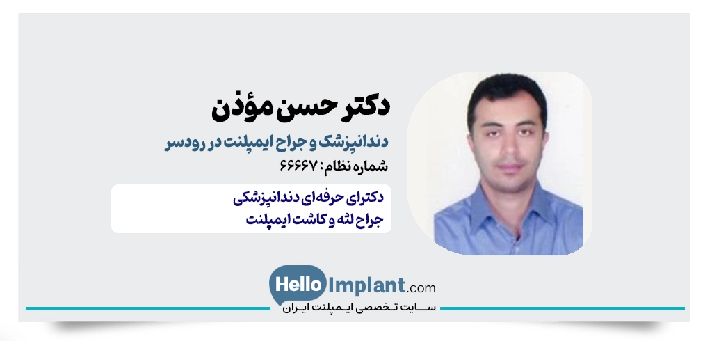 دکتر حسن مؤذن رضامحله | دندانپزشک ایمپلنت در رودسر