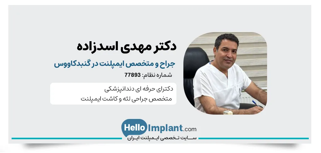 دکتر مهدی اسدزاده، دکتر ایمپلنت گنبد کاووس