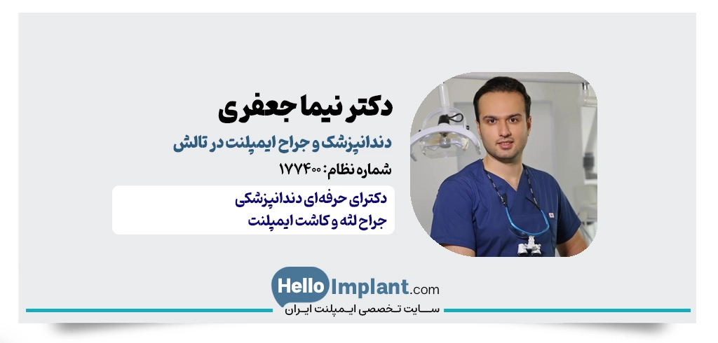 دکتر نیما جعفری – جراح ایمپلنت در تالش