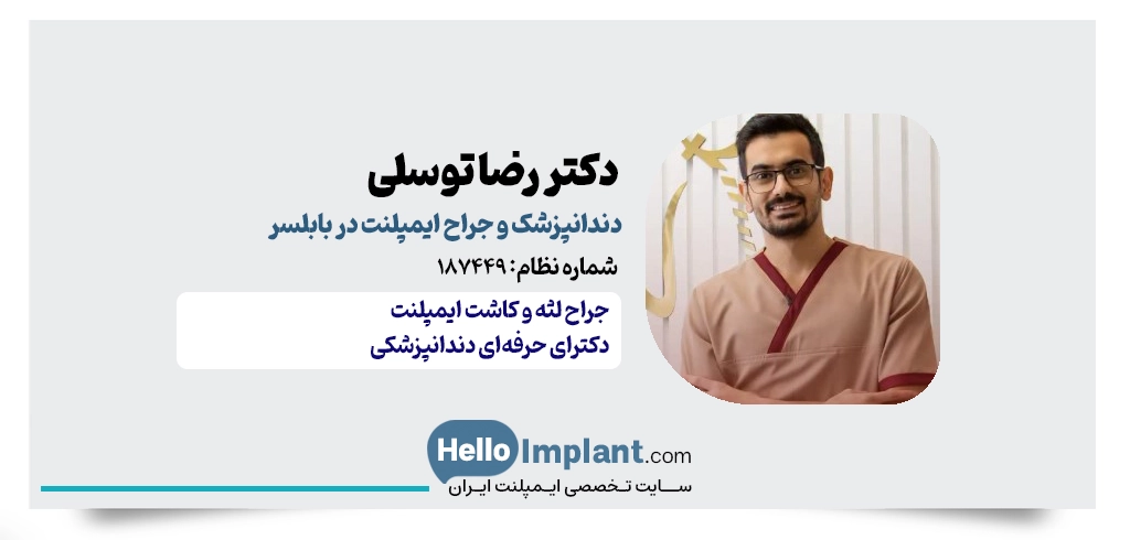 دکتر رضا توسلی | دندانپزشک و جراح ایمپلنت در بابلسر