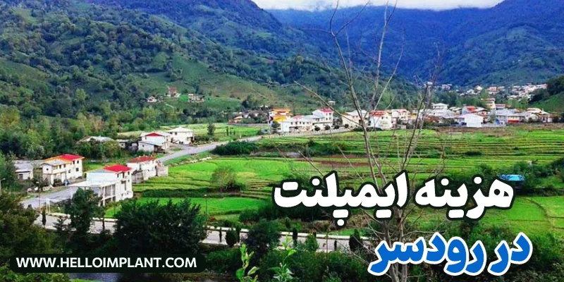 قیمت ایمپلنت در رودسر چقدر است؟