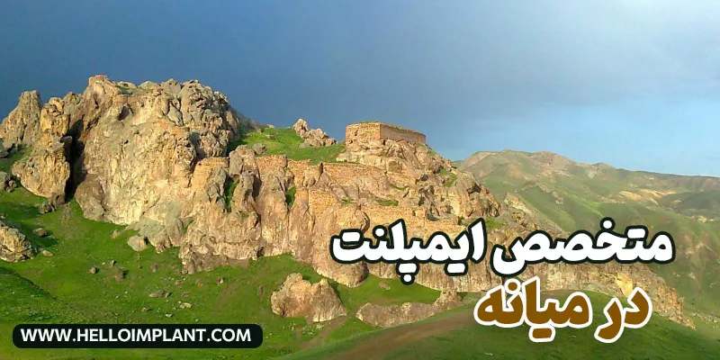 بهترین متخصص ایمپلنت دندان در میانه