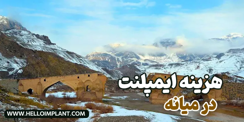 هزینه ایمپلنت در میانه 