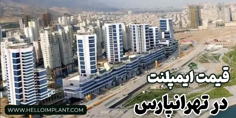 جدول قیمت انواع برند ایمپلنت دندان در سال 1404
