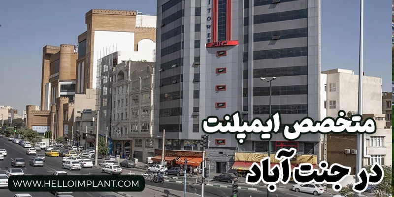بهترین متخصص ایمپلنت دندان در جنت آباد کیست؟