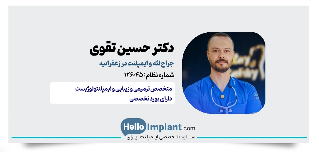 دکتر حسین تقوی | متخصص ترمیمی و ایمپلنت در زعفرانیه