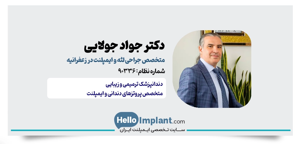 دکتر جواد جولایی | متخصص پروتز و ایمپلنت در زعفرانیه