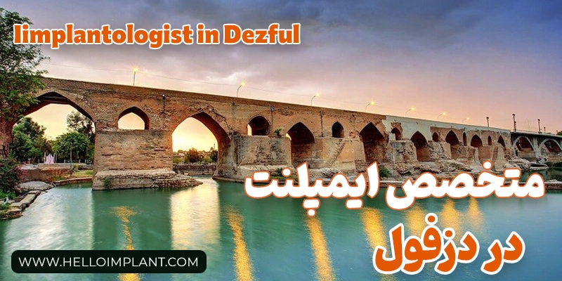 بهترین متخصص ایمپلنت در دزفول کیست؟
