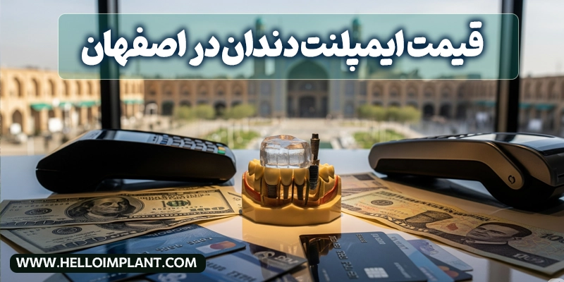 قیمت ایمپلنت دندان در اصفهان