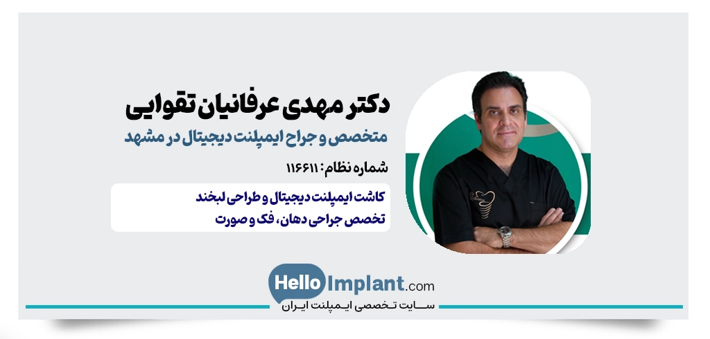دکتر مهدی عرفانیان تقوایی | کاشت ایمپلنت دیجیتال