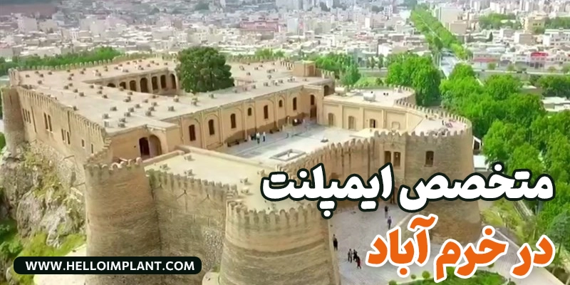 بهترین متخصص ایمپلنت در خرم آباد|راهنمای کامل و بروز ۱۴ پزشک