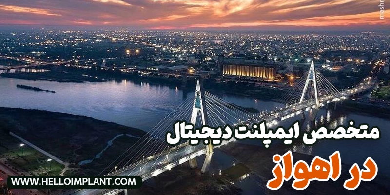 بهترین متخصصین ایمپلنت دیجیتال در اهواز