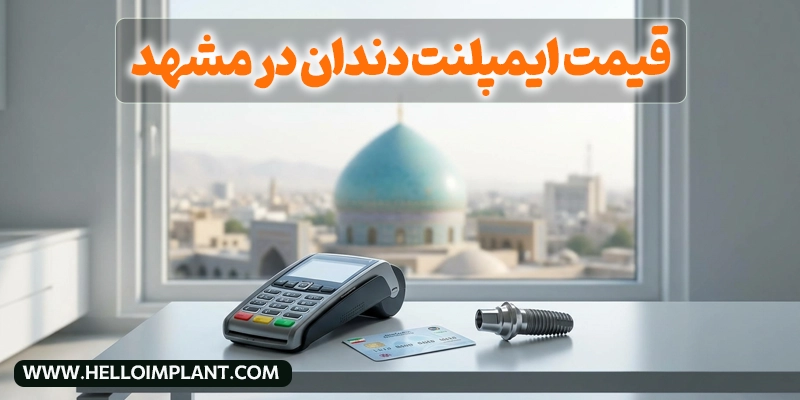 راهنمای کامل قیمت ایمپلنت دندان در مشهد