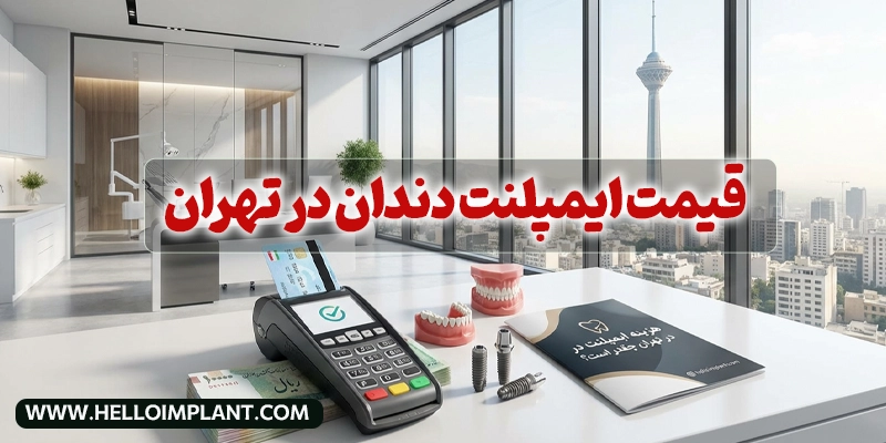 قیمت ایمپلنت دندان در تهران
