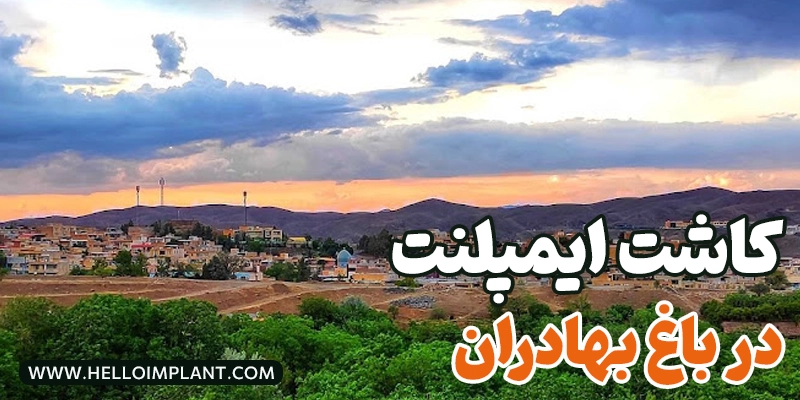 بهترین متخصص و مرکز کاشت ایمپلنت در باغ بهادران (لیست 5 جراح برتر ایمپلنت