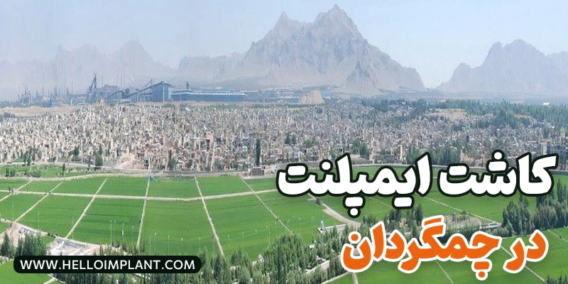 بهترین متخصص و مرکز کاشت ایمپلنت در چمگردان