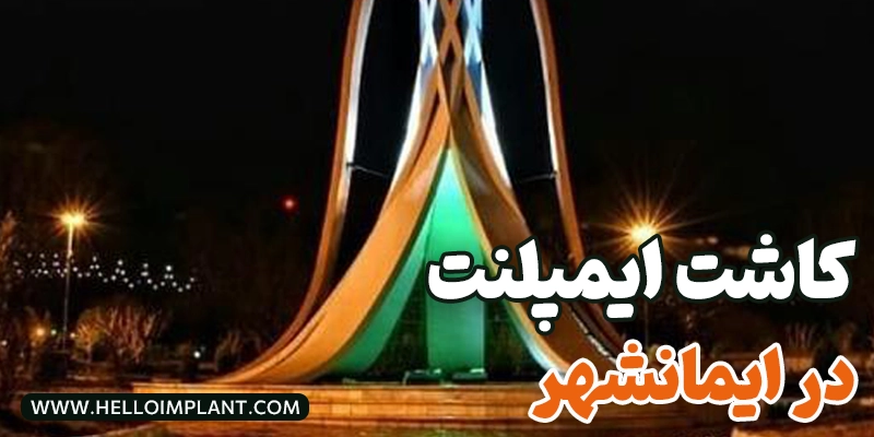 معرفی بهترین مرکز ایمپلنت و خدمات دندانپزشکی در ایمانشهر