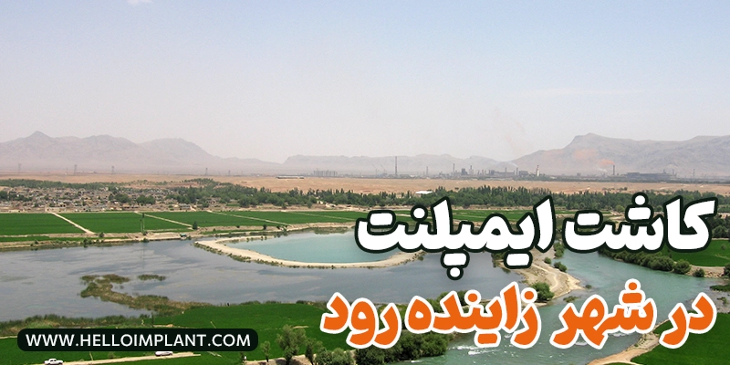 دندانپزشکی و مرکز کاشت ایمپلنت در زاینده‌ رود (تخصصی و اقساطی)