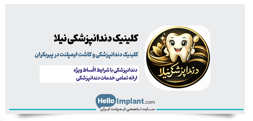 کلینیک دندانپزشکی نیلا | مرکز کاشت ایمپلنت قسطی در پیربکران
