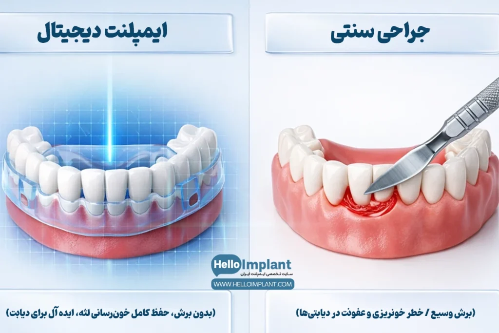 کاشت ایمپلنت دیجیتال برای افراد دیابتی
