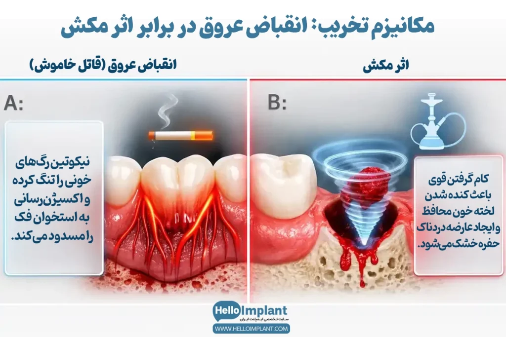 مصرف سیگار، قلیان و الکل بعد از ایمپلنت دندان