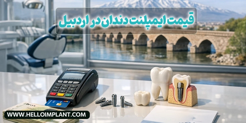 قیمت ایمپلنت دندان در اردبیل