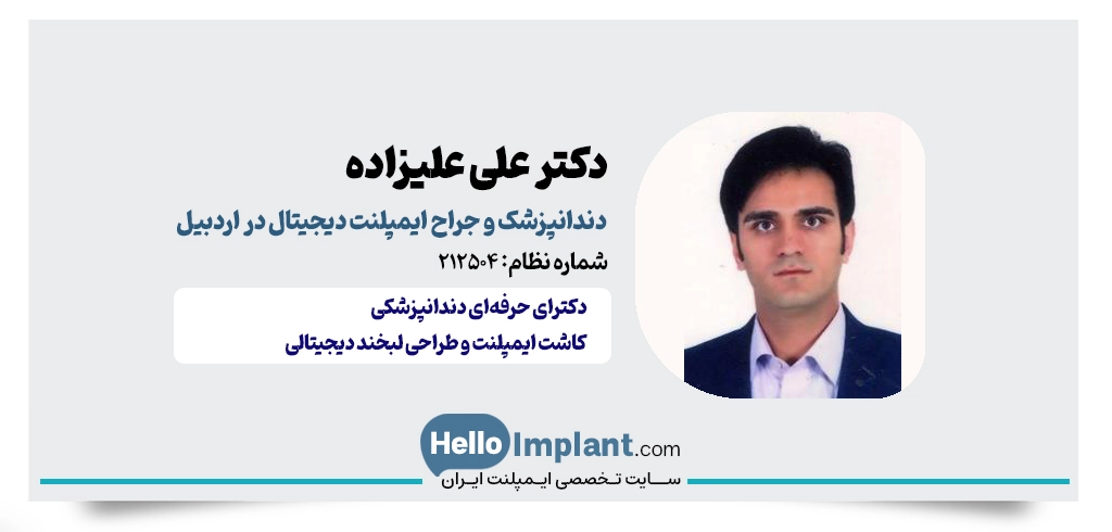 دکتر علی علیزاده؛ جراح ایمپلنت دیجیتال
