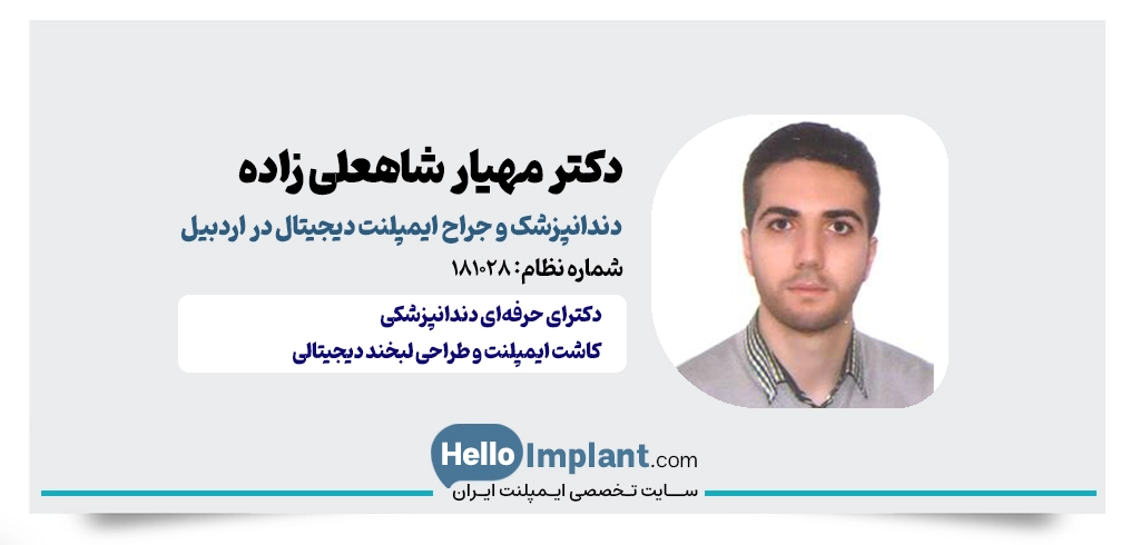 دکتر مهیار شاهعلی زاده؛ ایمپلنت دیجیتالی در اردبیل
